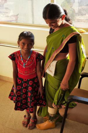 Indian woman with prosthetic leg standing next to little girl