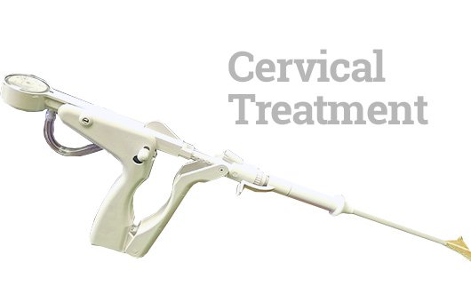 Cervical Treatment